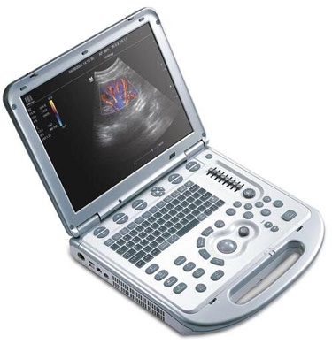 Chiropractic Nottingham MD Muscuoloskeletal Ultrasound Monitor